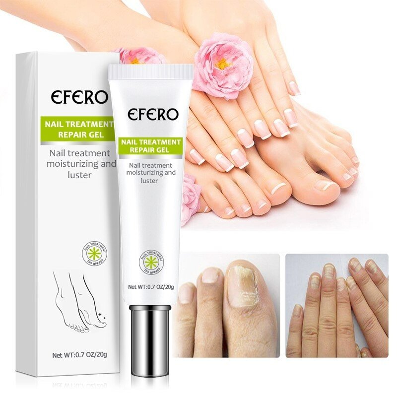 NailRepair™ – Résultats rapides, efficaces et durables [1 + 1 Gratuit]