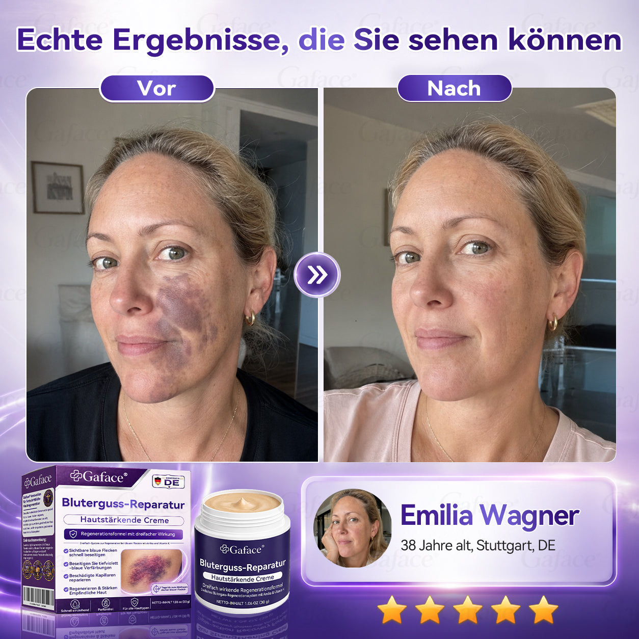 Crème Réparatrice à la Vitamine K et Calendula pour Peau Sensible