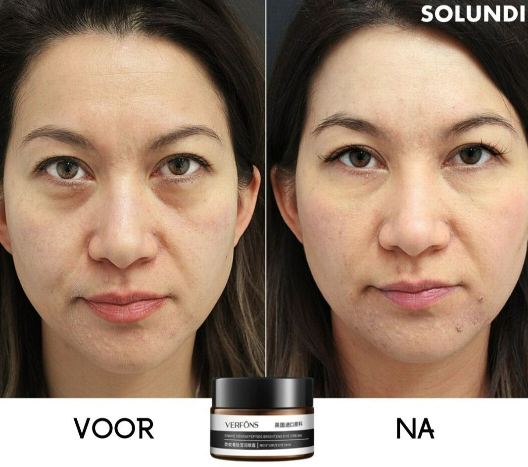 Crème Contour des Yeux Anti-Âge – Lissante, Ferme et Hydratante
