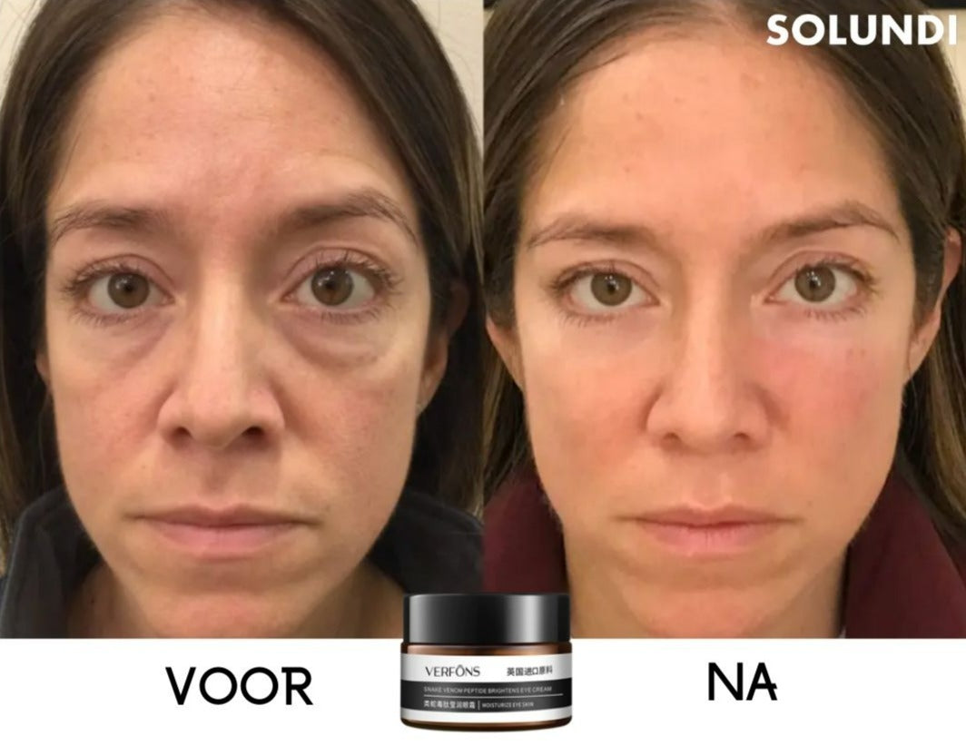 Crème Contour des Yeux Anti-Âge – Lissante, Ferme et Hydratante