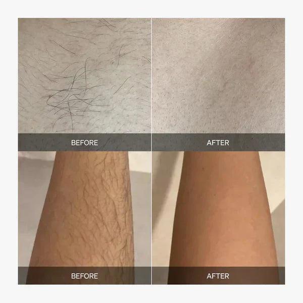 Éponge Épilation Sans Douleur Corps Entier – Peau Lisse et Douce