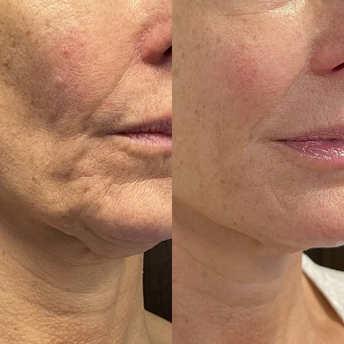 Stick Sérum Anti-Âge aux Peptides de Venin d'Abeille – Soin Raffermissant Visage