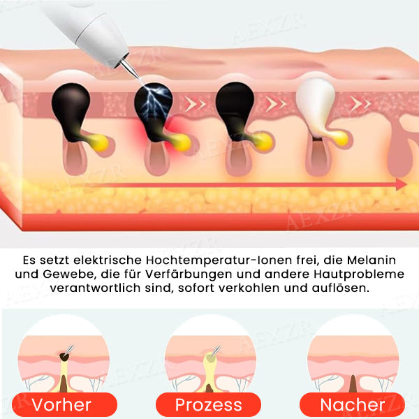 LuminSkin™ – Dites adieu aux imperfections de la peau