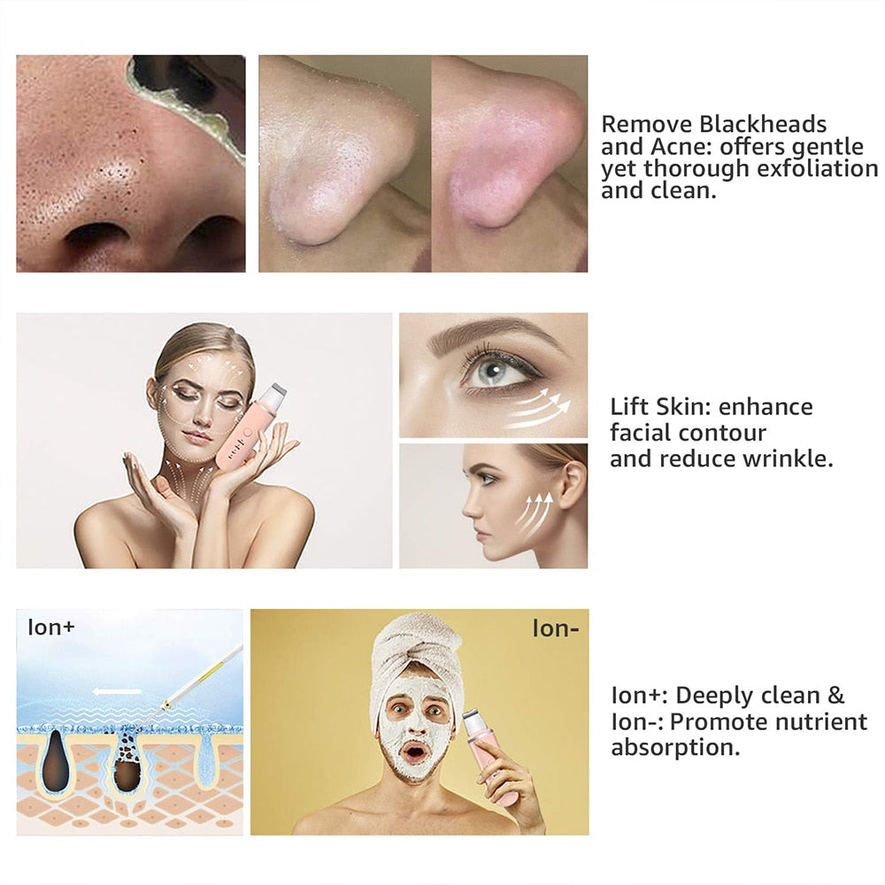Spatule Ultrasonique Nettoyage Profond des Pores & Éclat du Teint