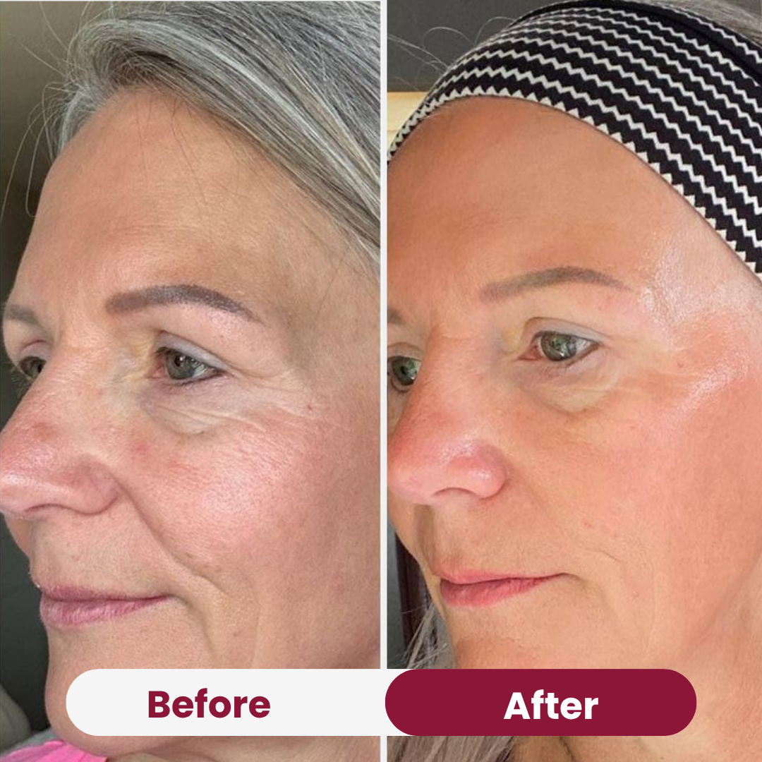 Nifora™ – Masque de Soin Intensif pour une Peau Jeune & Éclatante [1 + 1 Gratuit]