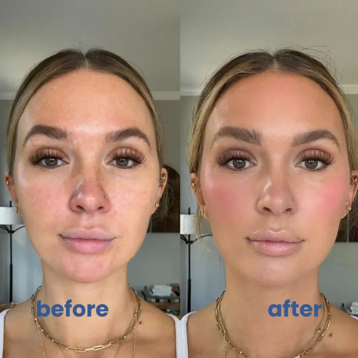 BrightSkin™ – Soin apaisant pour une peau parfaite et éclatante [1 + 1 Gratuit]