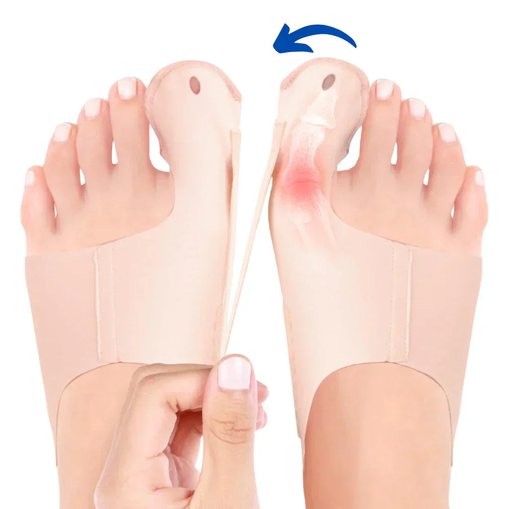 HalluxValgus™ - Votre solution confortable pour des pieds sans douleur ! [1 + 1 Gratuit]