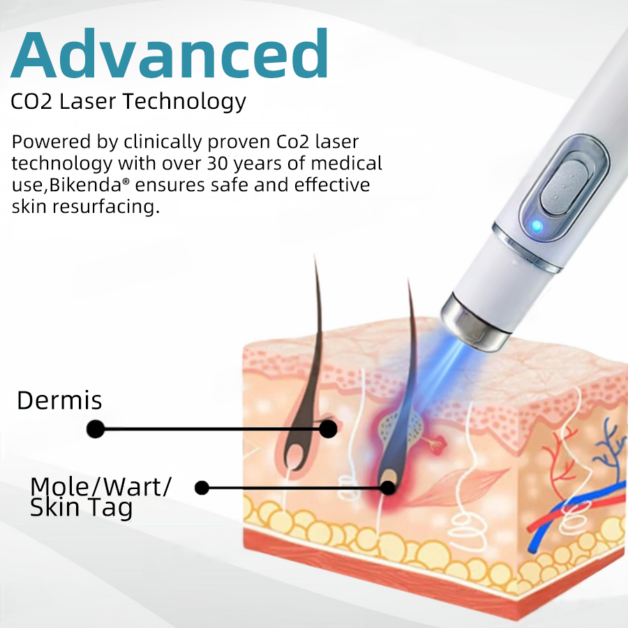 Stylo Laser CO₂ pour Enlever Verrues, Grains de Beauté et Taches Cutanées