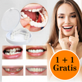 Facettes Dentaires Thermoformables pour un Sourire Blanc et Éclatant