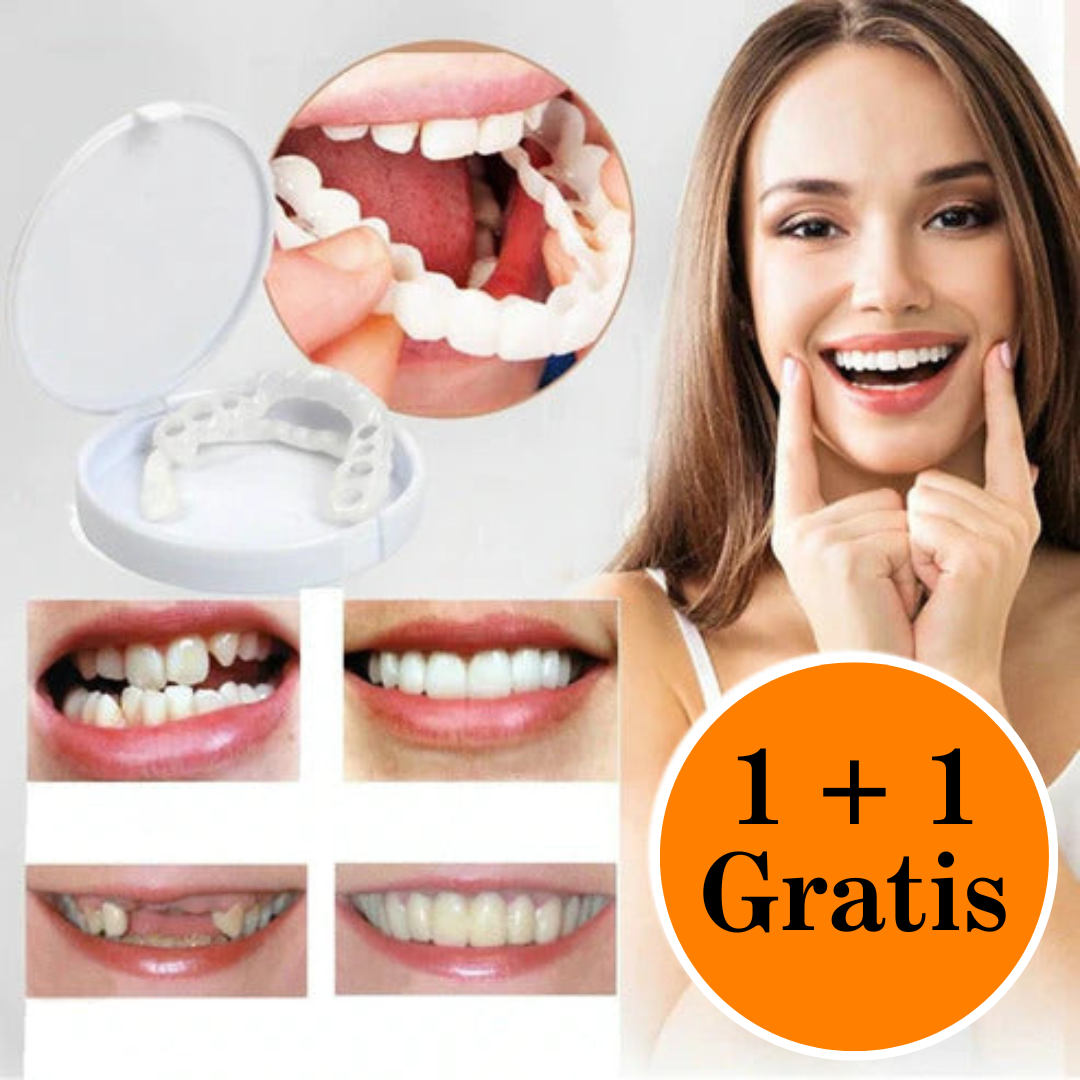 Facettes Dentaires Thermoformables pour un Sourire Blanc et Éclatant