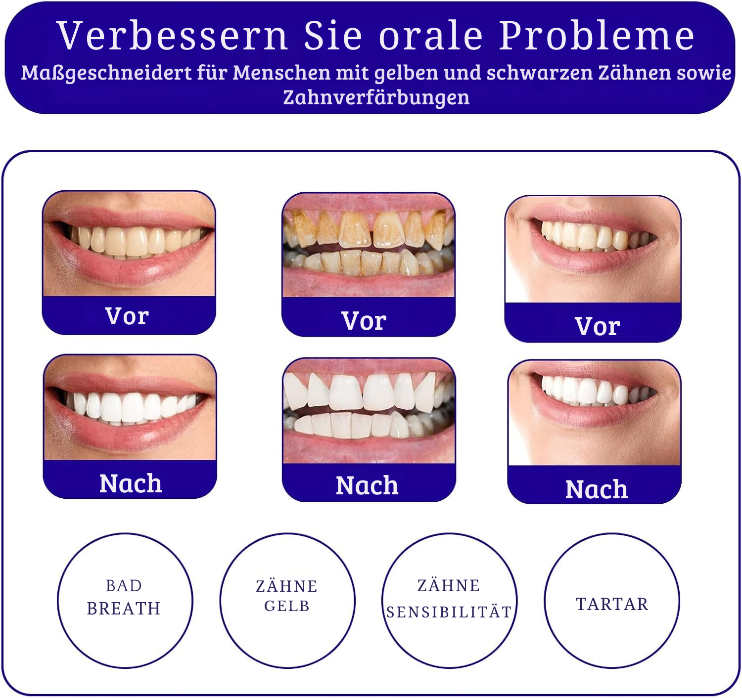WhiteSmile™ – Sérum Correcteur de Teinte & Dentifrice Violet pour des Dents d’un Blanc Éclatant [1 + 1 Gratuit]