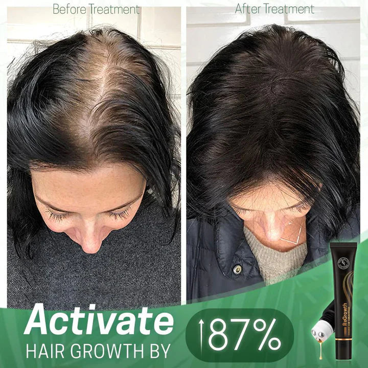 Sérum Capillaire Nourrissant au Roller – Cheveux Forts et Brillants
