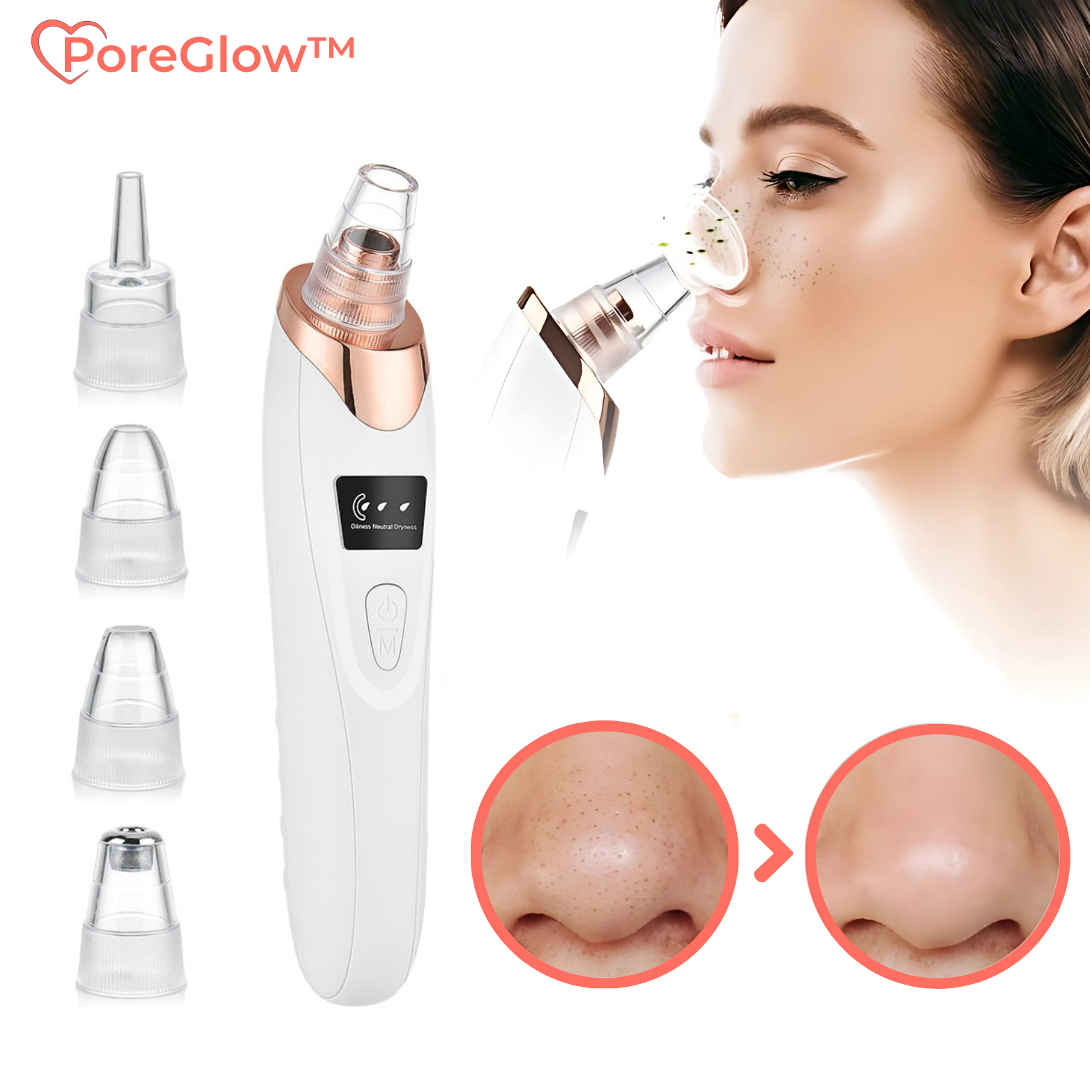Aspirateur de Points Noirs à Vide avec 5 Embouts pour Visage