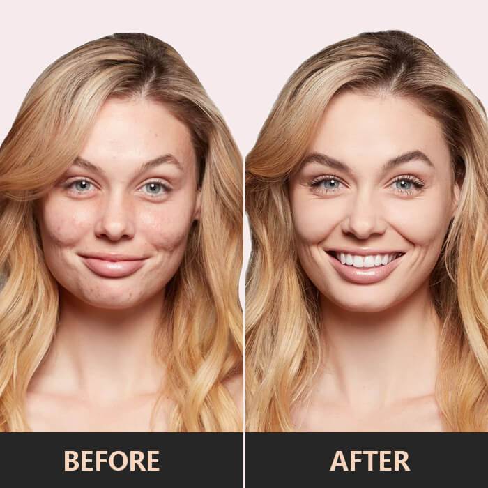 Athena™ – Correction de la peau sans couture, lisse et naturelle [50% de réduction]