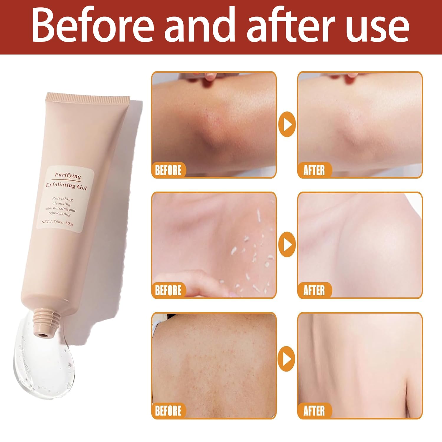 FreshSkin™ – Révèle une peau soyeuse, éclatante et lisse [1 + 1 Gratuit]