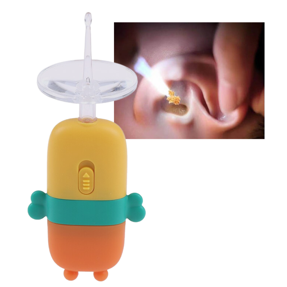 ClearScope™ – Élimination douce du cérumen [50 % de réduction]