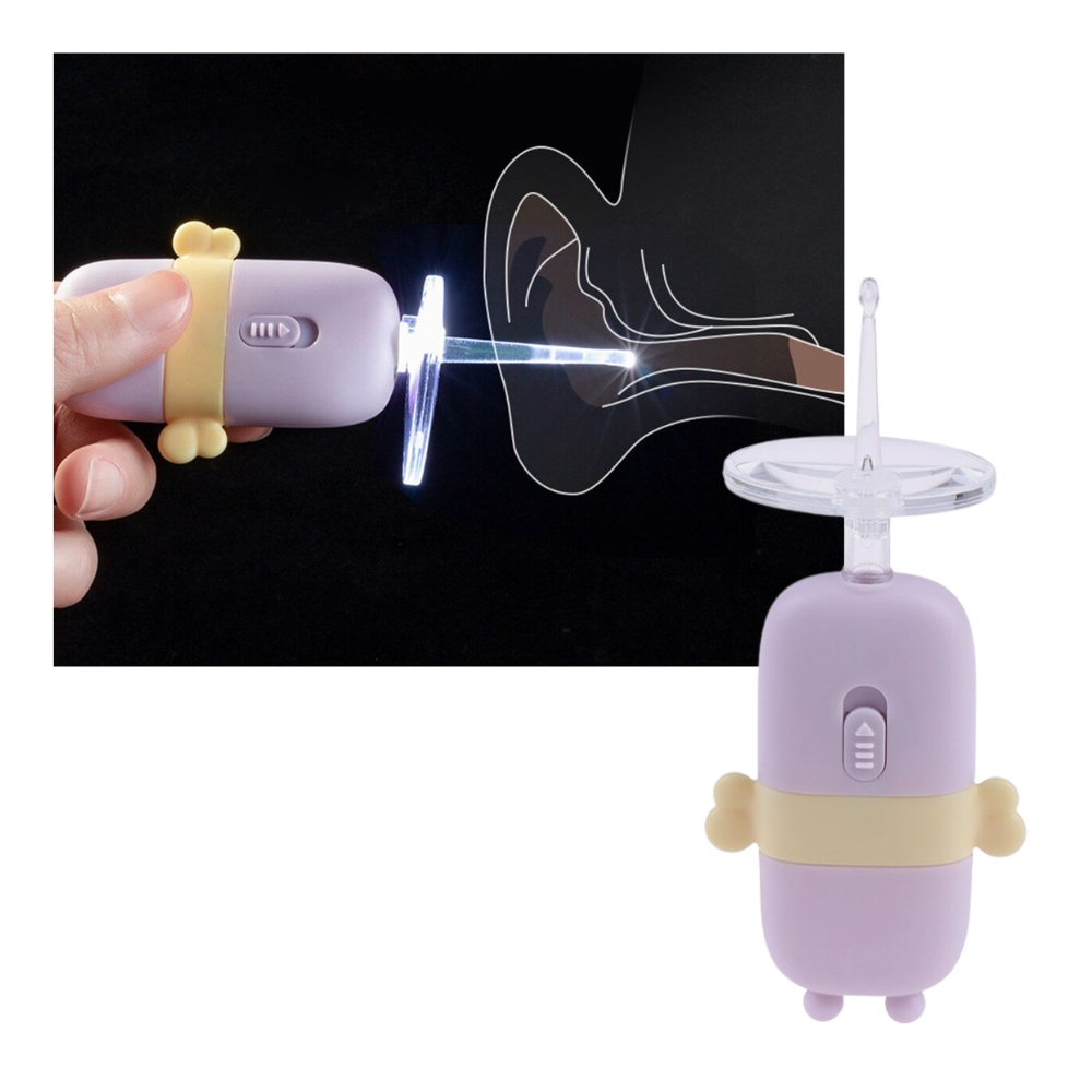 ClearScope™ – Élimination douce du cérumen [50 % de réduction]