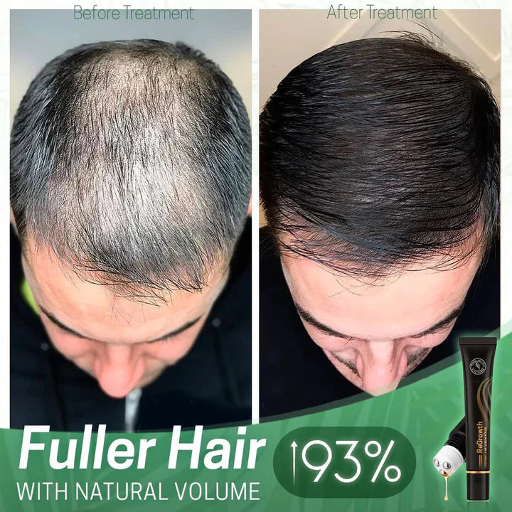 Sérum Capillaire Nourrissant au Roller – Cheveux Forts et Brillants
