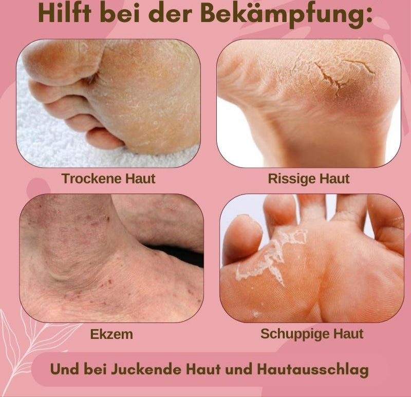 SoleRjejuve™ – Soin des pieds instantané et nourrissant pour des pieds doux [1 + 1 Gratuit]