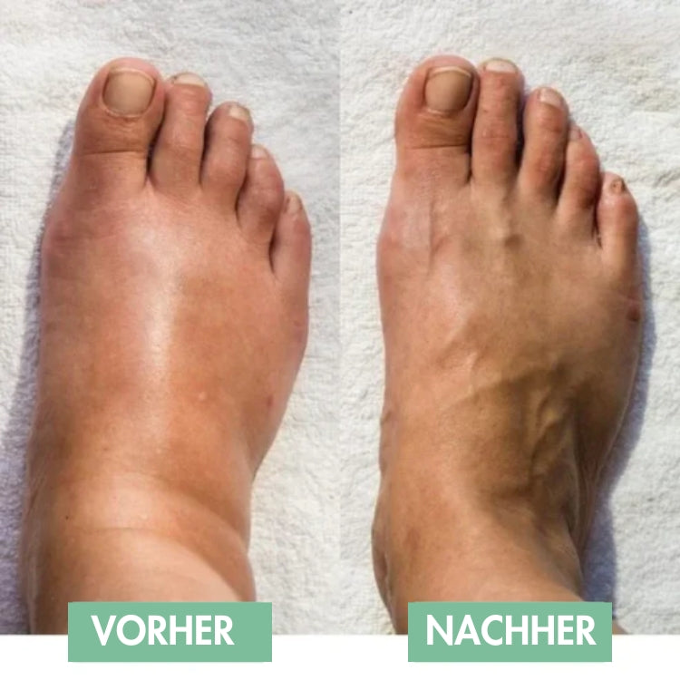 Revivax™ - Le massage des pieds EMS innovant pour un soulagement immédiat ! [50% de réduction]