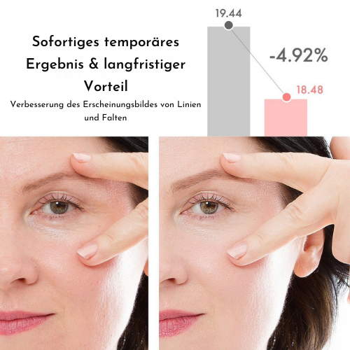 jugendlicherbalken™ – Pour un contour des yeux lisse, éclatant et d’apparence jeune [1 + 1 Gratuit]
