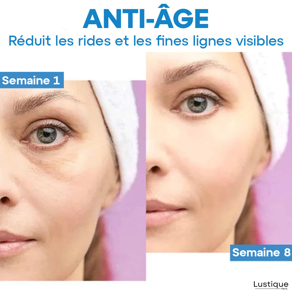 VitaVision™ – Revitalisez vos yeux fatigués pour un regard éveillé instantané [1 + 1 Gratuit]