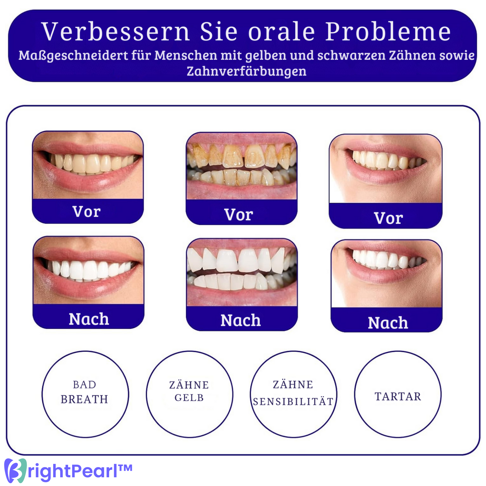 Dentifrice Violet Sérum Correcteur de Couleur pour Dents Éclatantes
