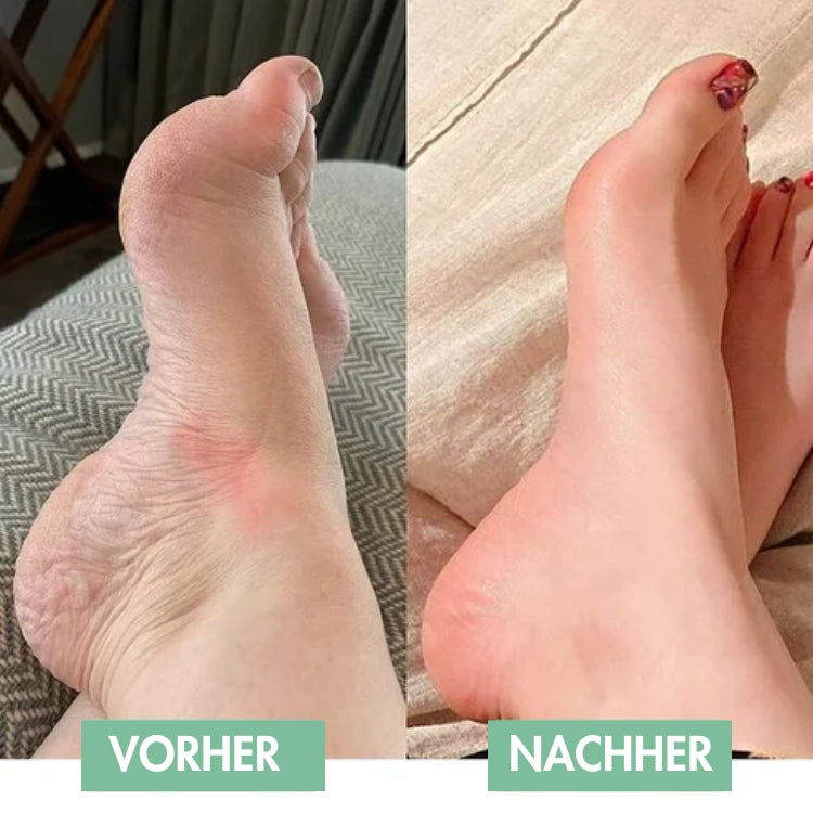 Revivax™ - Le massage des pieds EMS innovant pour un soulagement immédiat ! [50% de réduction]