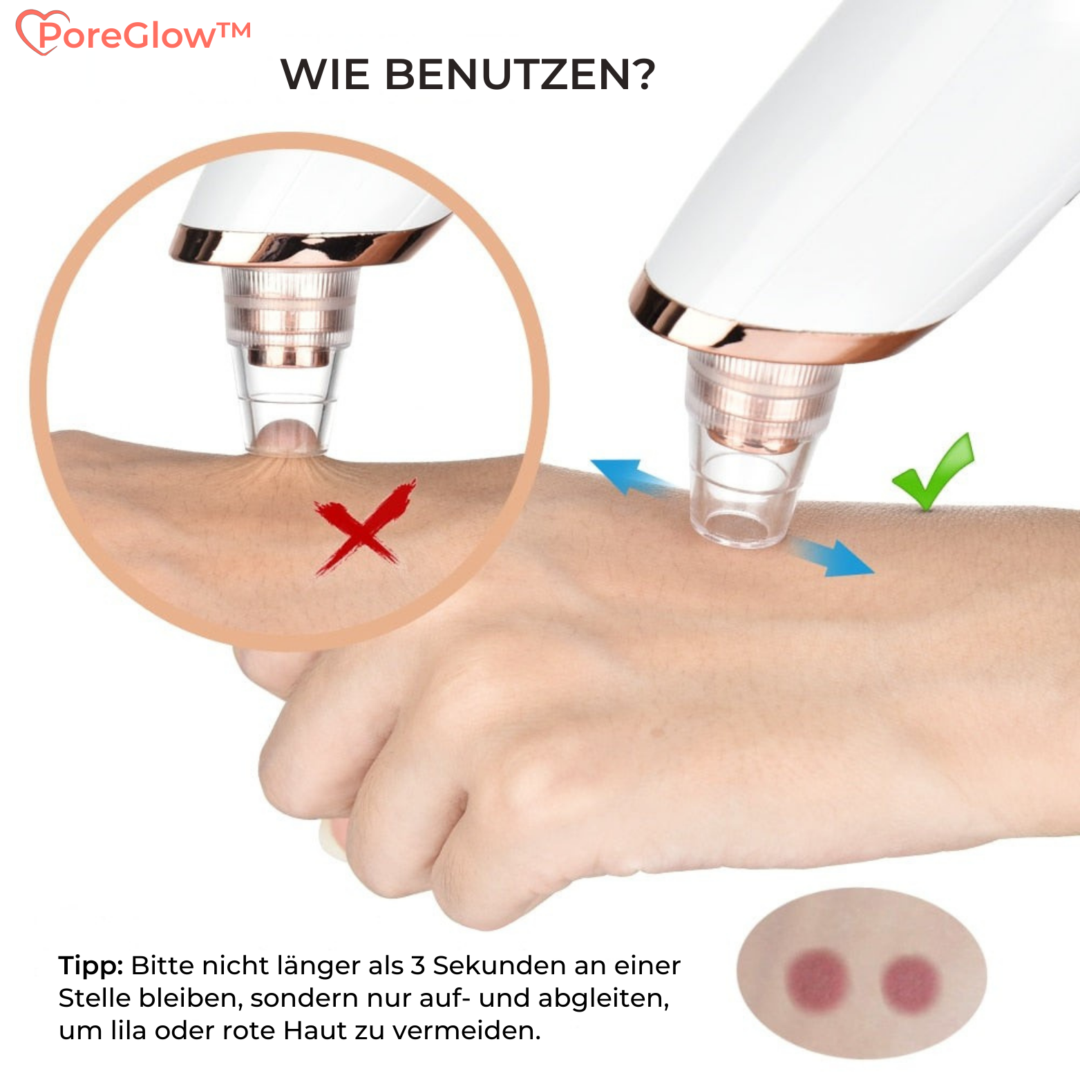 Aspirateur de Points Noirs à Vide avec 5 Embouts pour Visage