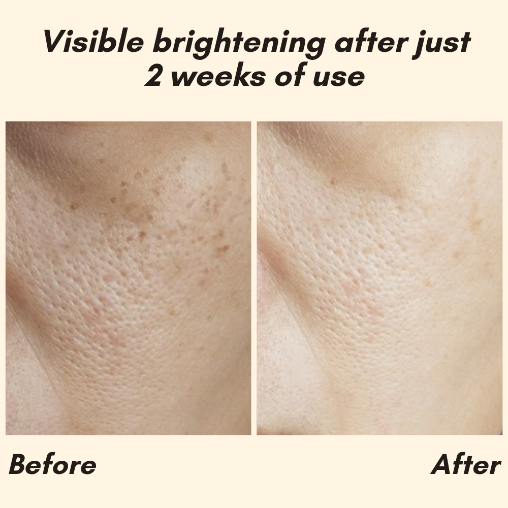 Sérum Vitamine C Visage, Mains et Corps pour une Peau Éclatante