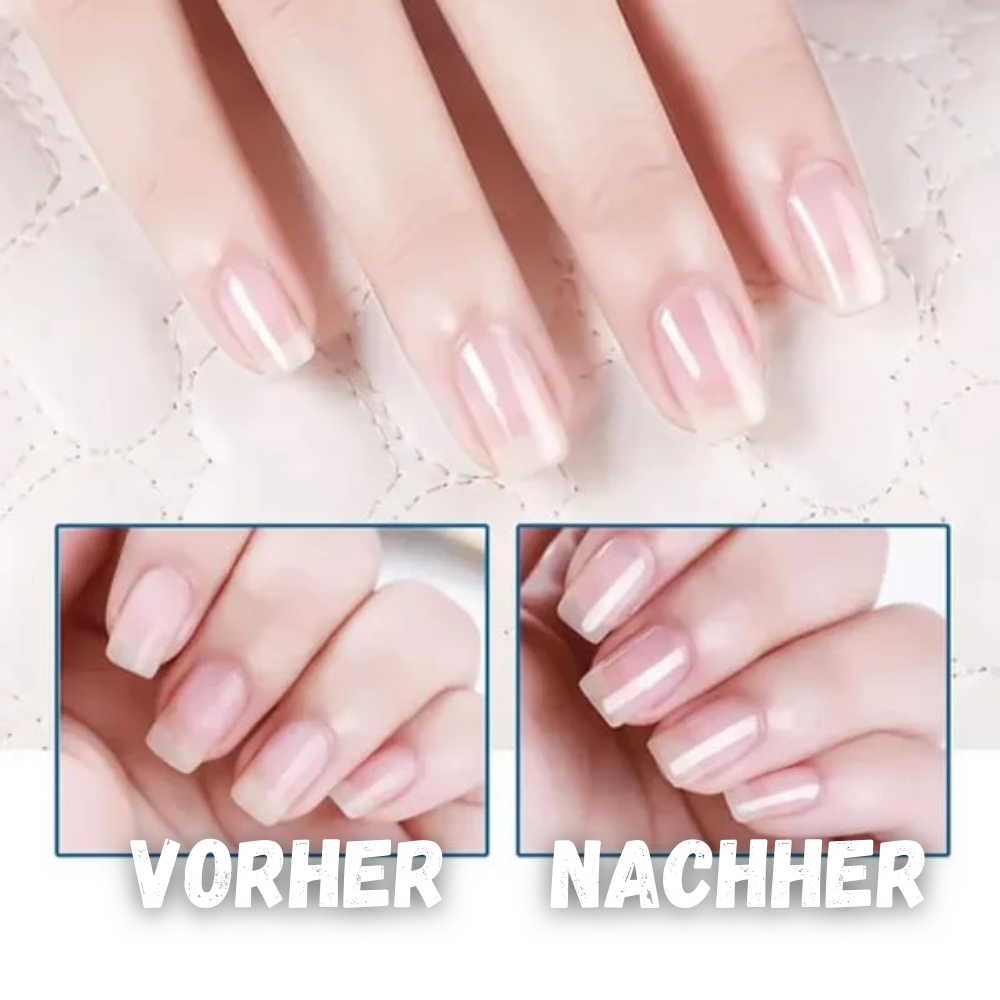 Huile de Soin pour Ongles et Cuticules – Hydratante et Nourrissante