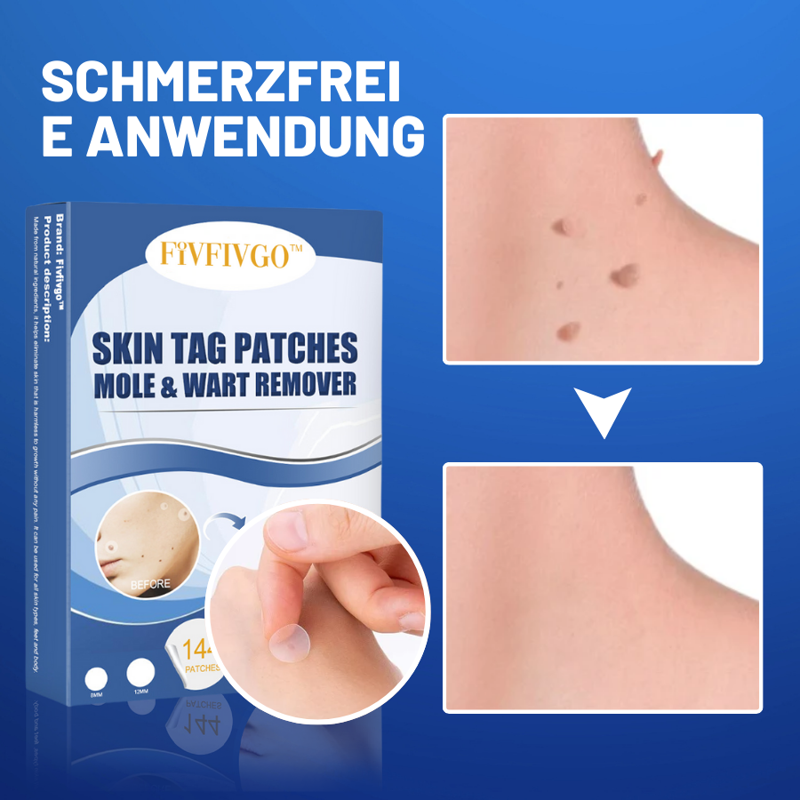 PatchAway™ – Éliminez les lambeaux de peau sans douleur et sans effort [50 % de réduction]