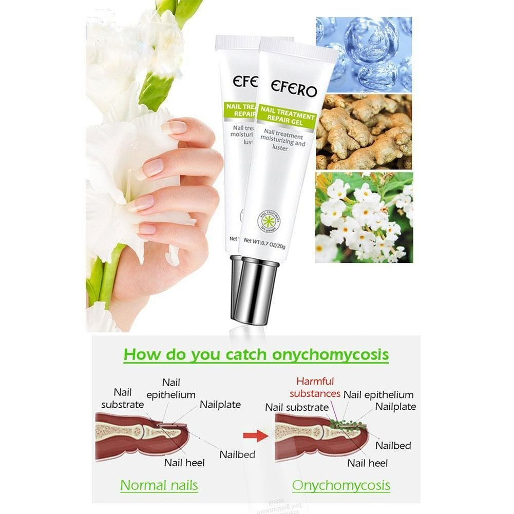 Soin Fortifiant pour Ongles – Gel Réparateur contre les Mycoses