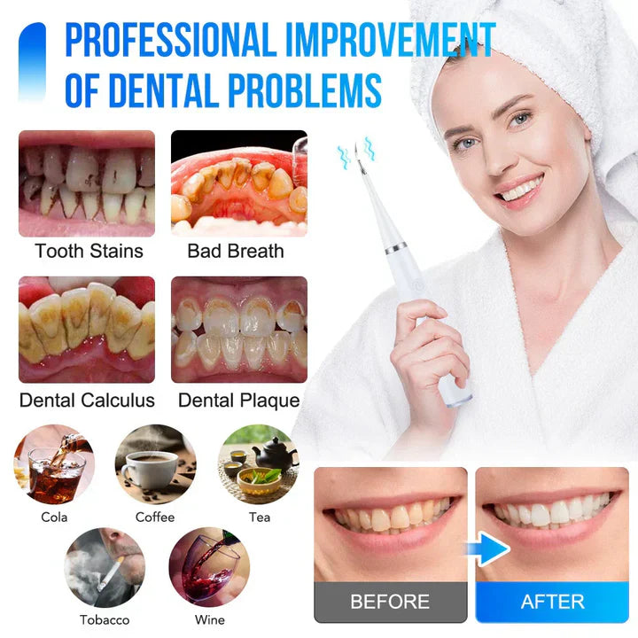 ToothCleaner™ – Nettoyeur de dents électrique [50% de réduction]