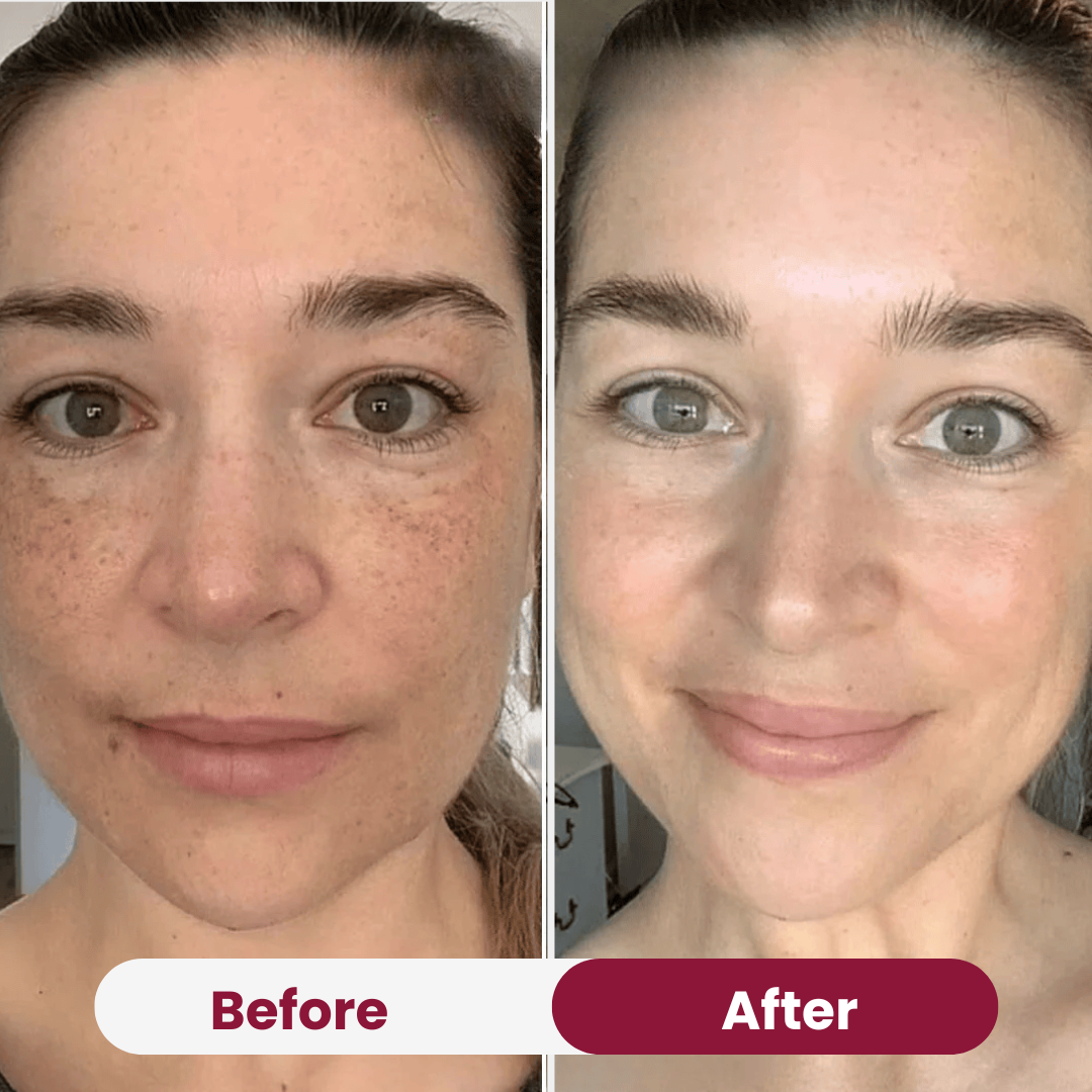 Nifora™ – Masque de Soin Intensif pour une Peau Jeune & Éclatante [1 + 1 Gratuit]