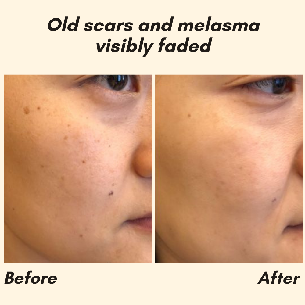 Sérum Vitamine C Visage, Mains et Corps pour une Peau Éclatante
