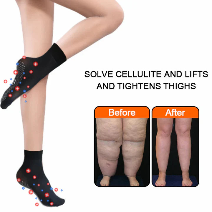 ShapeSocks™ – L’astuce ultime pour accélérer votre perte de poids [1 + 1 Gratuit]