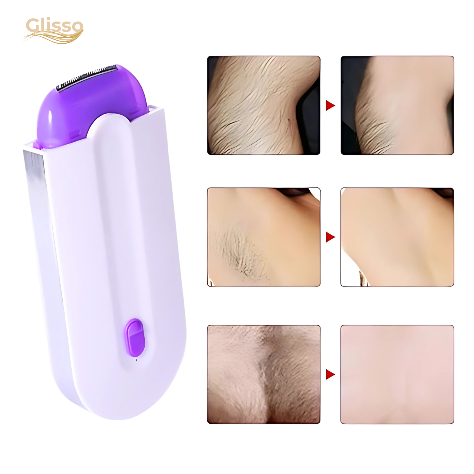 Épilateur Électrique Doux pour Visage et Corps – Peau Soyeuse