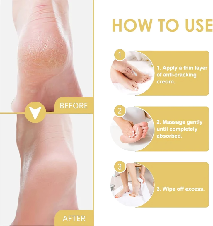 HydraHeel™ – Crème nourrissante et apaisante pour un soulagement quotidien [1 + 2 Gratuit]