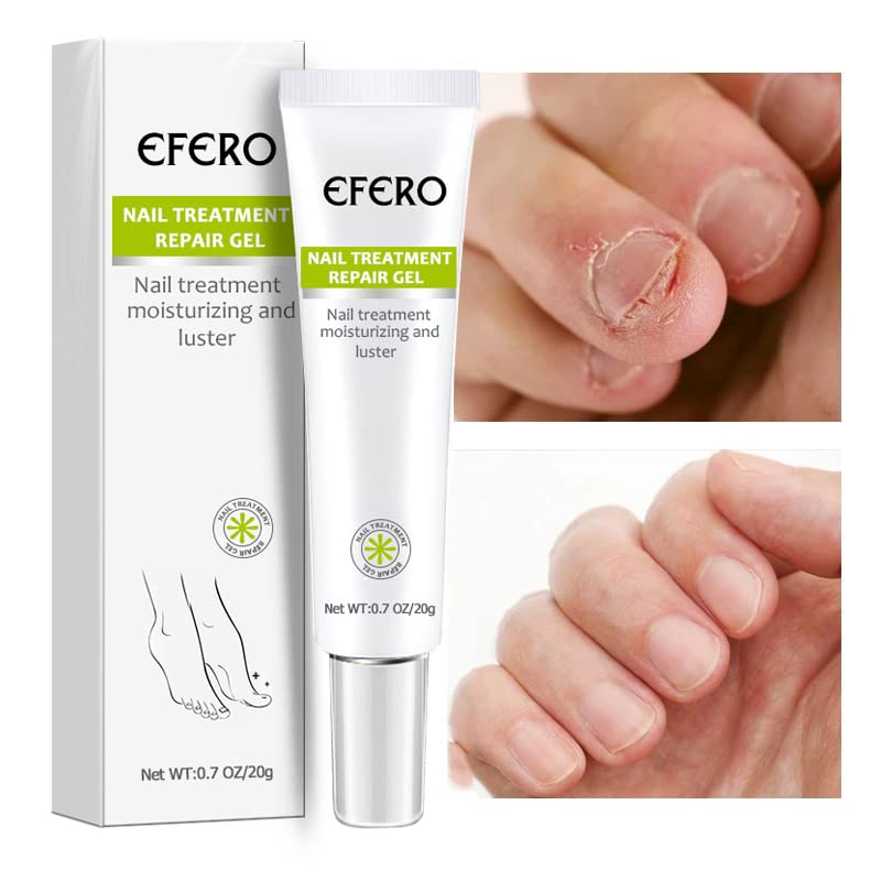 Soin Fortifiant pour Ongles – Gel Réparateur contre les Mycoses