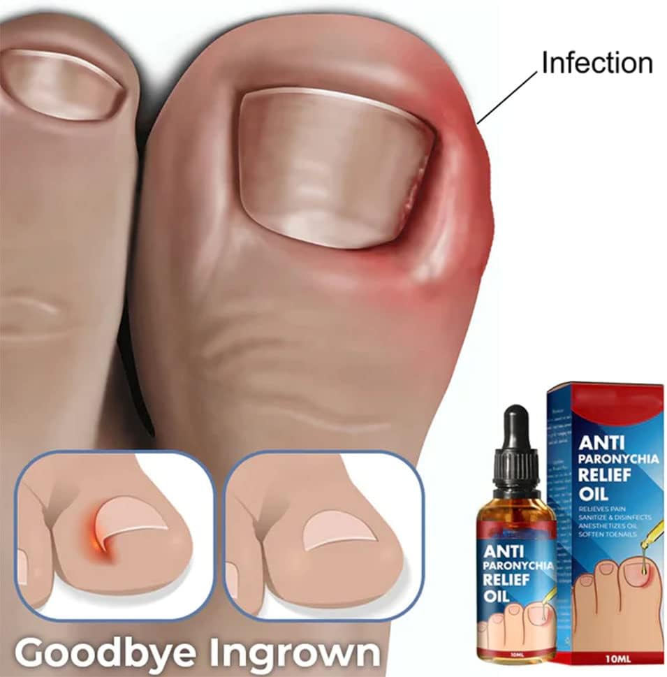 HealDrop™ – Répare les ongles abîmés en 4 semaines [1 + 1 Gratuit]