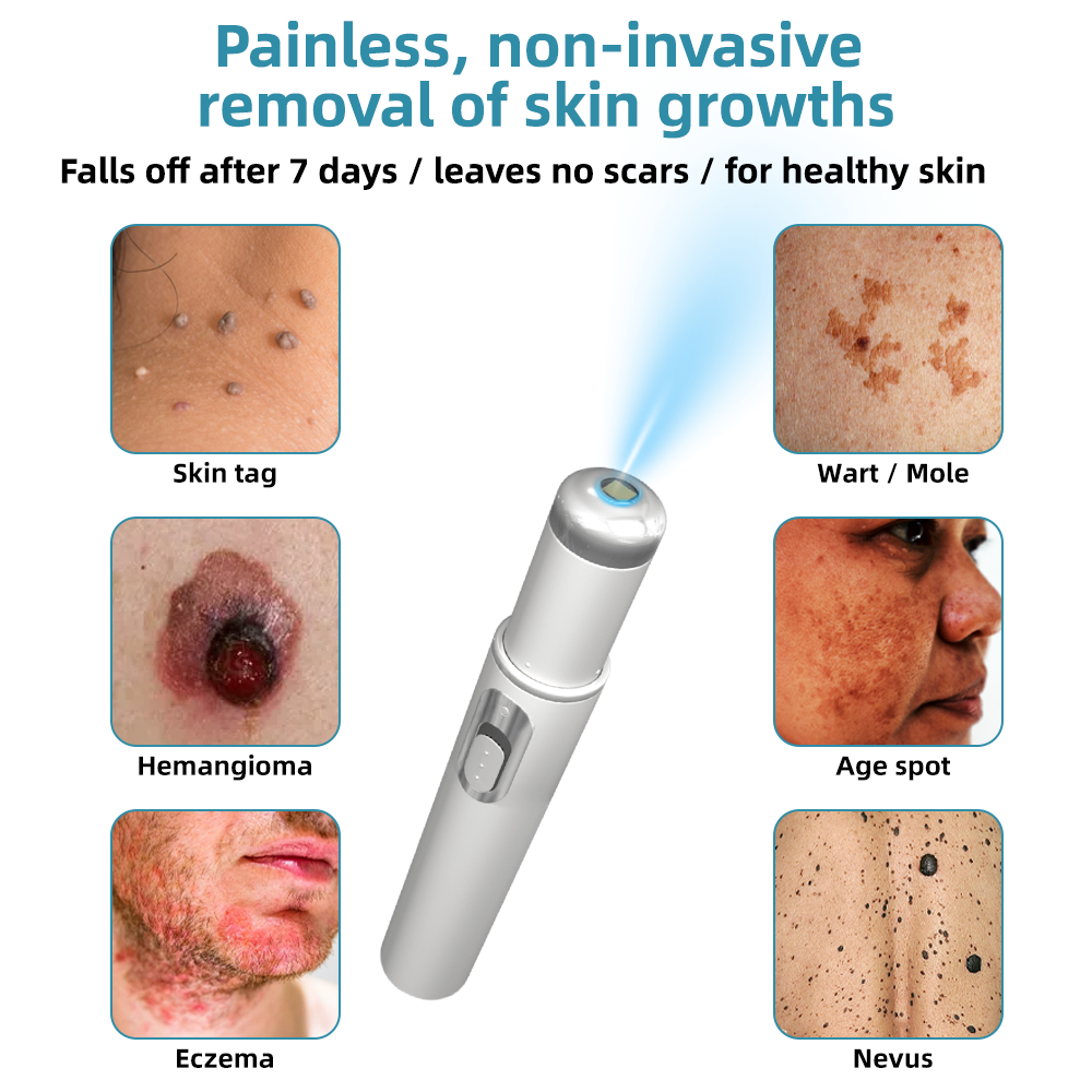 Stylo Laser CO₂ pour Enlever Verrues, Grains de Beauté et Taches Cutanées