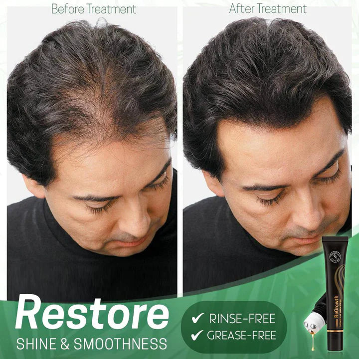 Sérum Capillaire Nourrissant au Roller – Cheveux Forts et Brillants