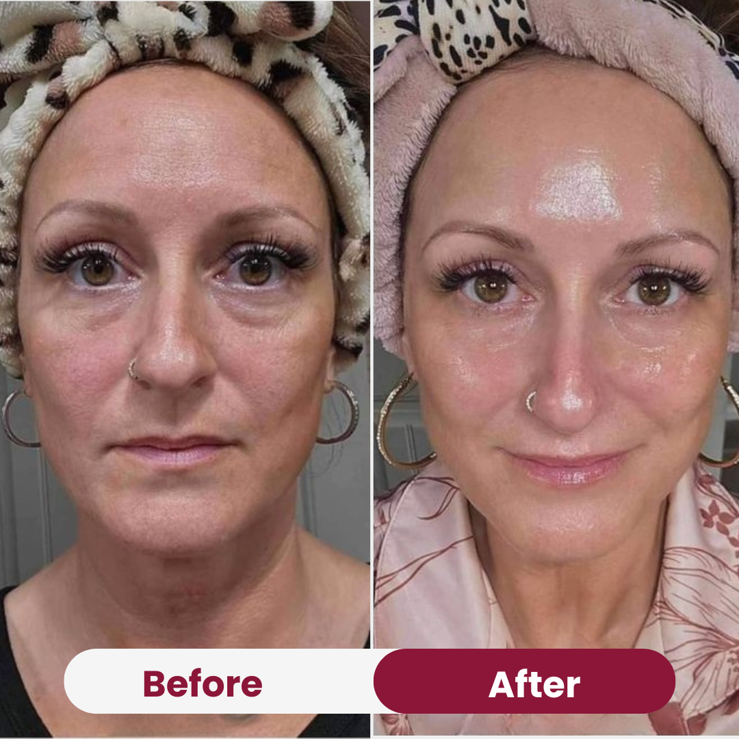 Nifora™ – Masque de Soin Intensif pour une Peau Jeune & Éclatante [1 + 1 Gratuit]