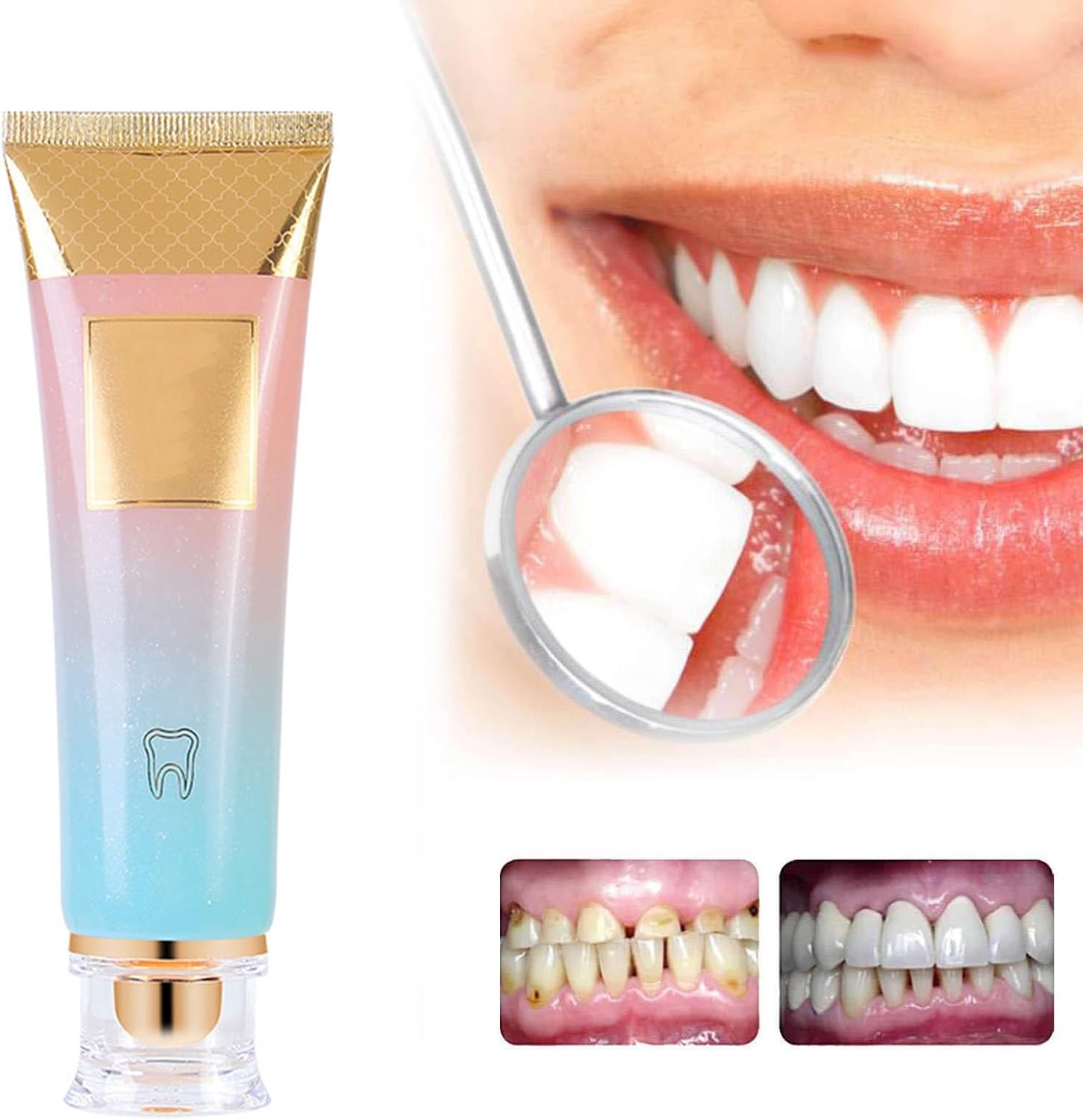 BrightSmile™ – Des dents d’un blanc éclatant sans sensibilité [1 + 1 Gratuit]