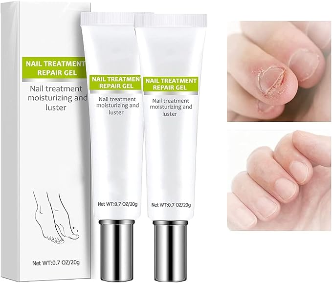 RejuveNail™ – Renforce Durablement des Ongles Sains & Élégants [1 + 1 Gratuit]