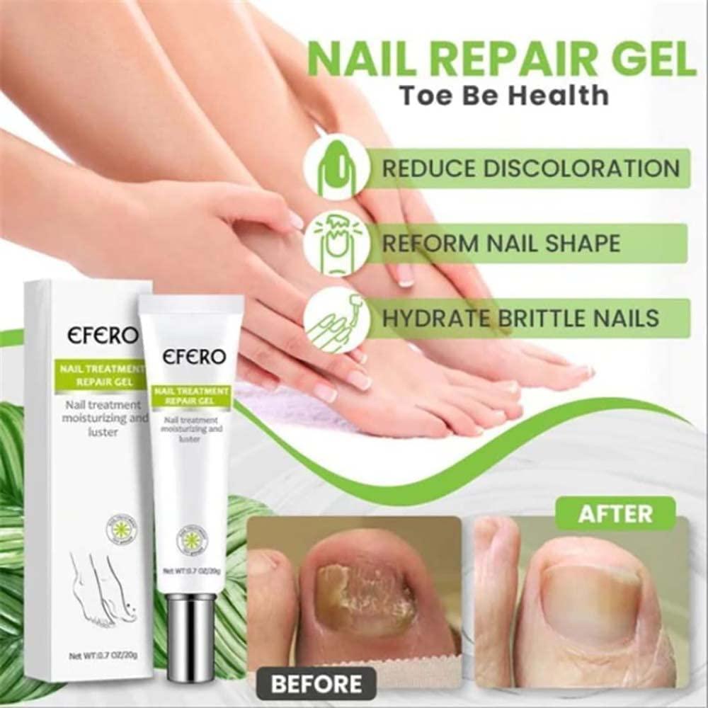 RejuveNail™ – Renforce Durablement des Ongles Sains & Élégants [1 + 1 Gratuit]