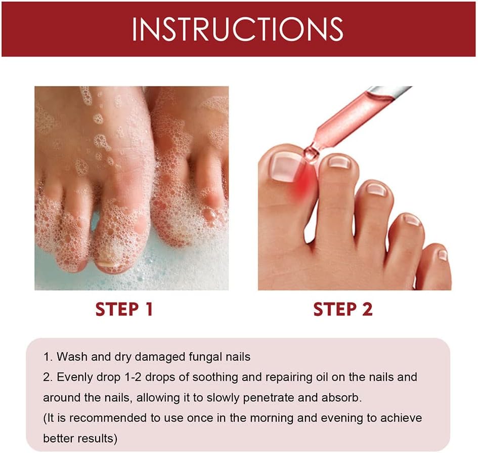 HealDrop™ – Répare les ongles abîmés en 4 semaines [1 + 1 Gratuit]