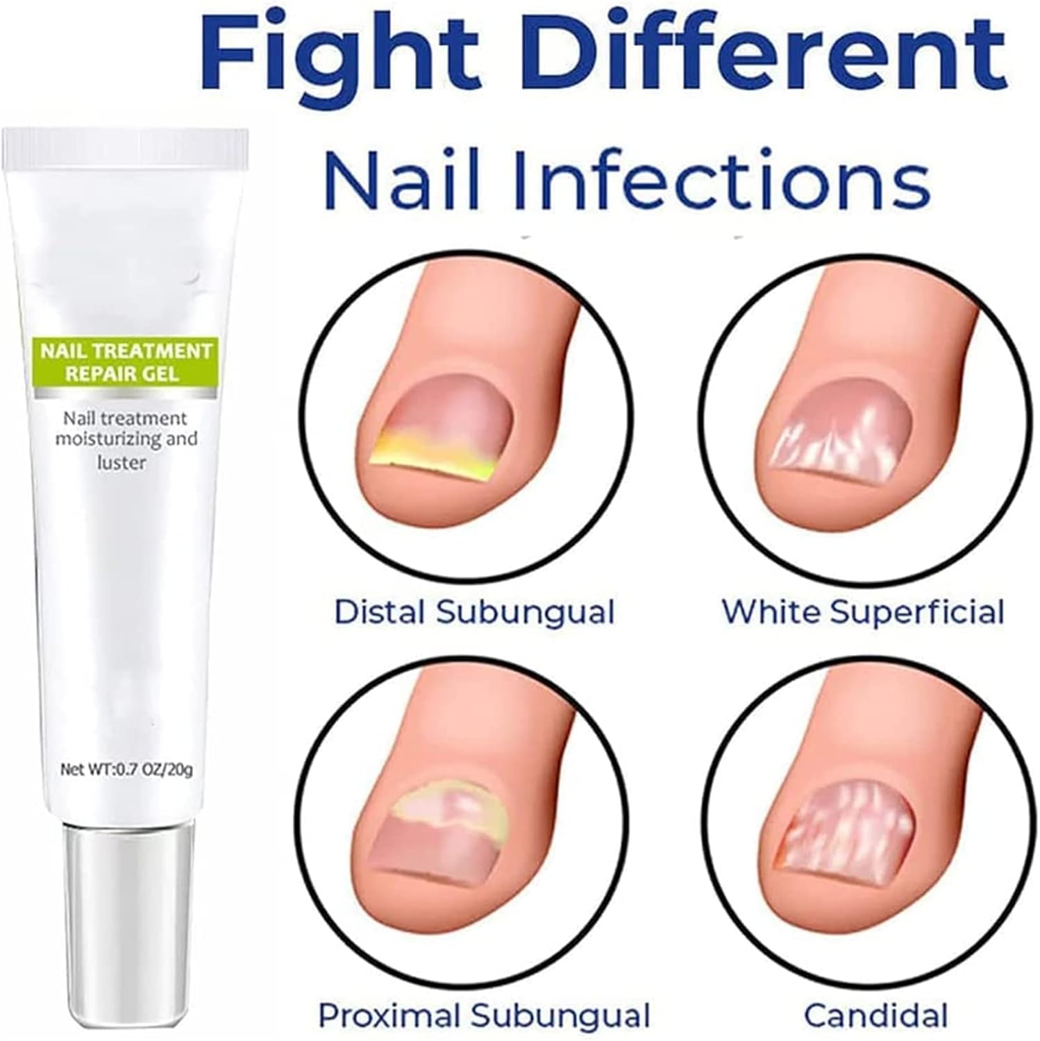 RejuveNail™ – Renforce Durablement des Ongles Sains & Élégants [1 + 1 Gratuit]