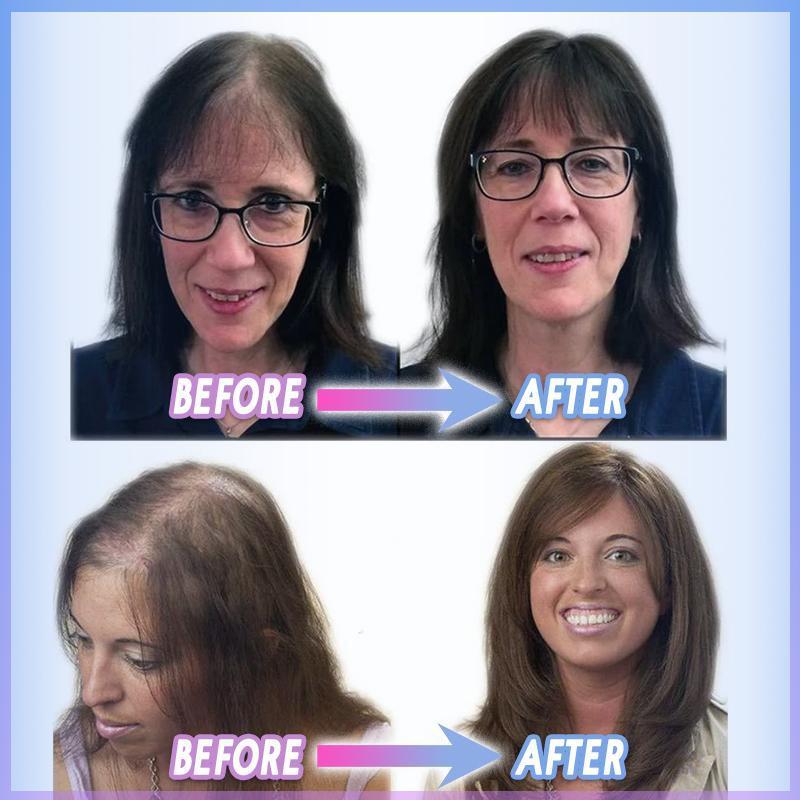 ClipHair™ – Élastique magique à clipser pour les cheveux [50 % de réduction]